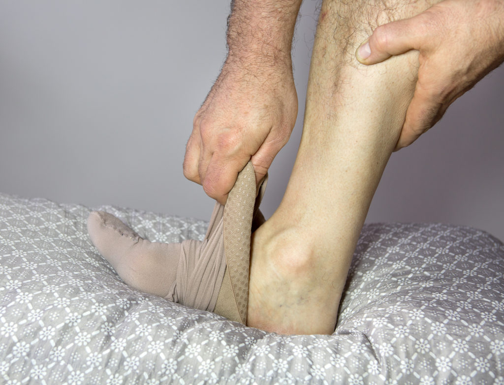 Leg Ulcers Treatment Clark Ky